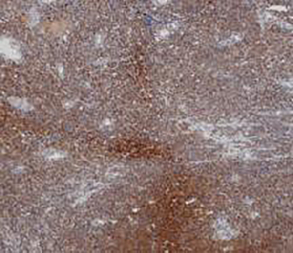 NSE Recombinant Mouse Monoclonal Antibody (clone BPM6150)