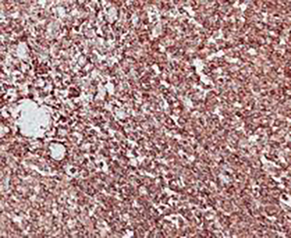 Collagen Type IV Recombinant Rabbit Monoclonal Antibody (clone BP6072)