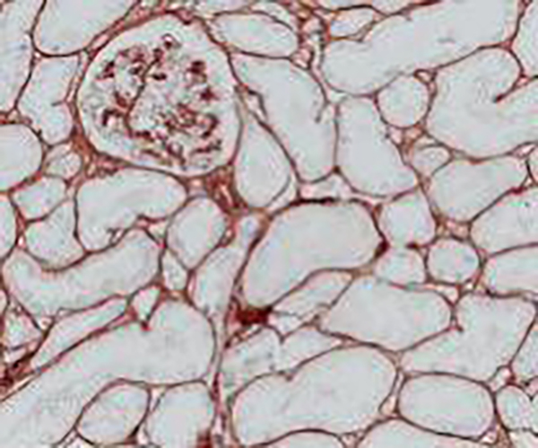 Napsin A Recombinant Rabbit Monoclonal Antibody (clone BP6083)