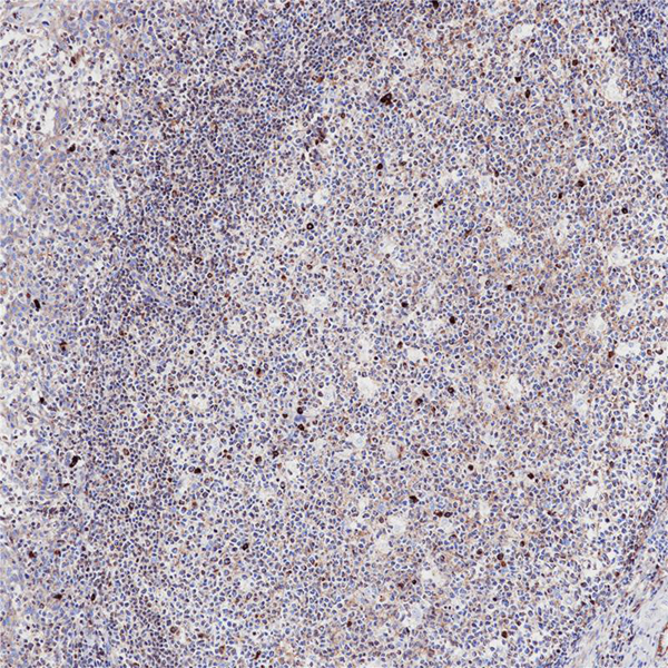 Actin (Smooth Muscle) Recombinant Mouse Monoclonal Antibody (clone 1A4)