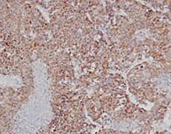VEGF Recombinant Rabbit Monoclonal Antibody (clone BP6213)