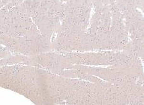 pan-TRK Recombinant Rabbit Monoclonal Antibody (clone BP6210)