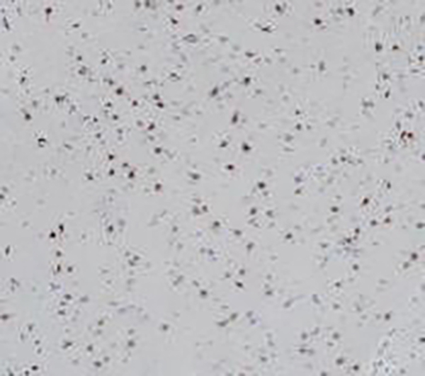 CD146 Recombinant Rabbit Monoclonal Antibody (clone BP6162)
