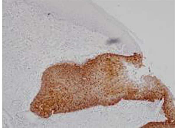 p16 Recombinant Mouse Monoclonal Antibody (clone BPM6238)