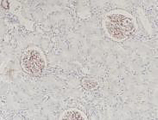COL4A5 Recombinant Rabbit Monoclonal Antibody (clone BP6206)