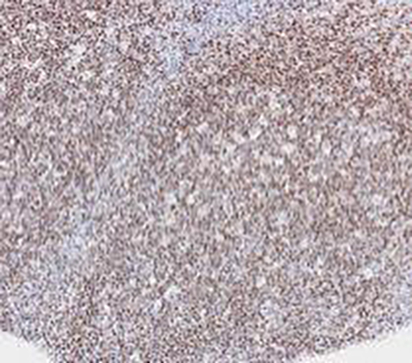 Estrogen Receptor &alpha; Recombinant Rabbit Monoclonal Antibody (clone BP6139)