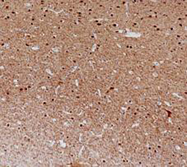 Neurofilament Recombinant Mouse Monoclonal Antibody (clone BPM6226)
