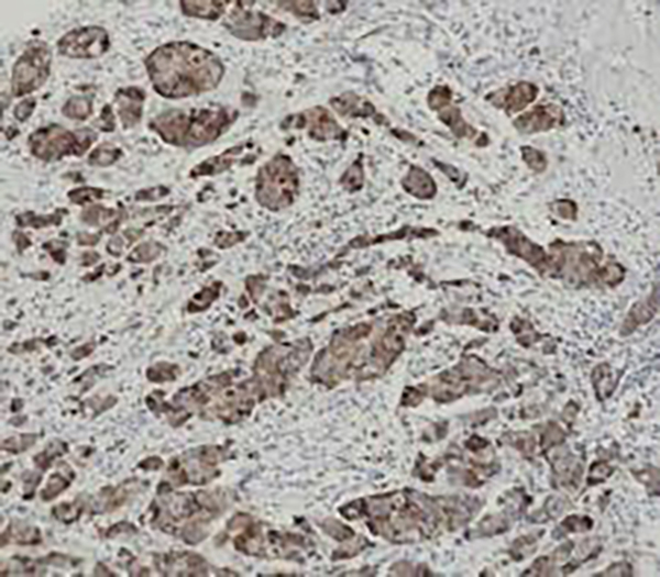 Lambda Light Chains Recombinant Rabbit Monoclonal Antibody (clone BP6133)