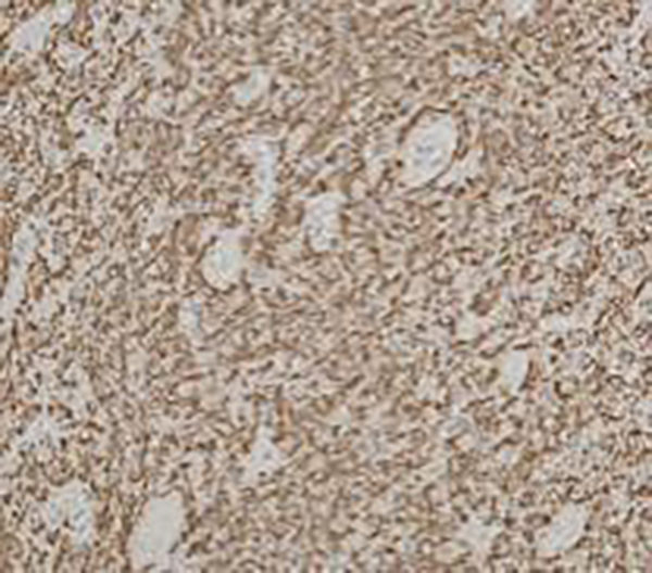 Melan-A Recombinant Rabbit Monoclonal Antibody (clone BP6086)