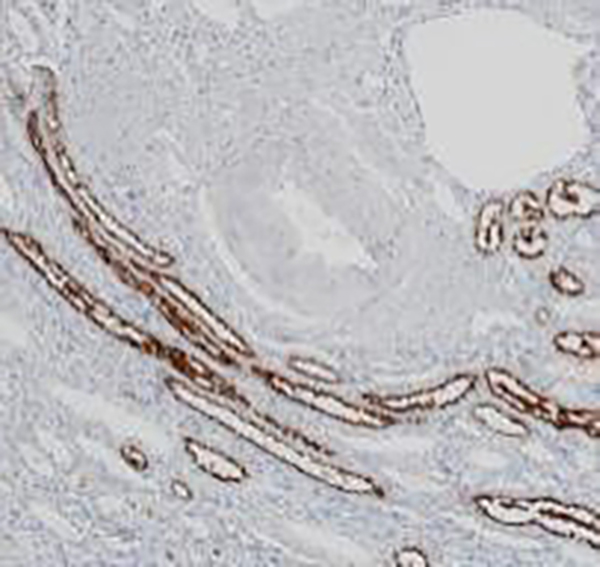 ACE2 Recombinant Rabbit Monoclonal Antibody (clone BP6153)