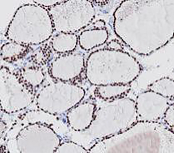 Cytokeratin 1 Recombinant Rabbit Monoclonal Antibody (clone BP6077)