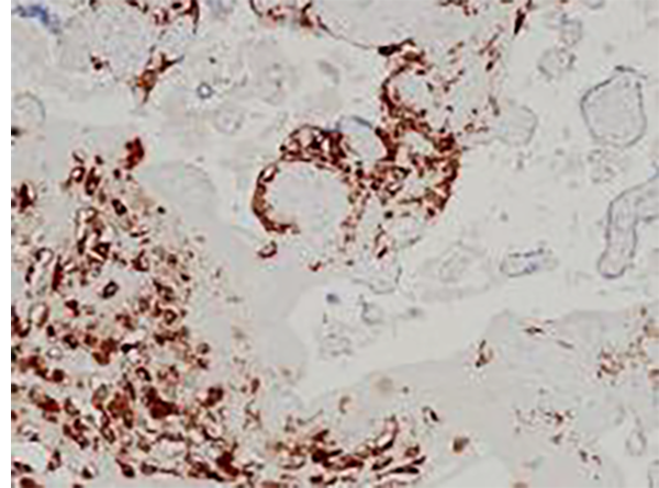 HLA-G Recombinant Rabbit Monoclonal Antibody (clone BP6247)