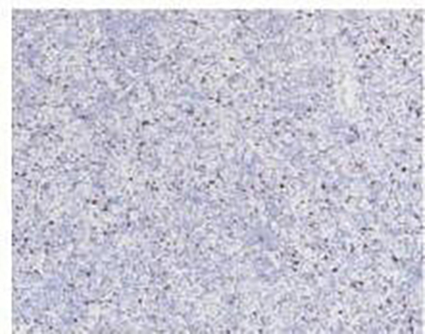 LAG-3 Recombinant Rabbit Monoclonal Antibody (clone BP6192)