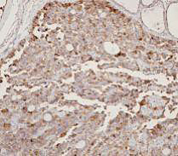ERG Recombinant Rabbit Monoclonal Antibody (clone BP6127)