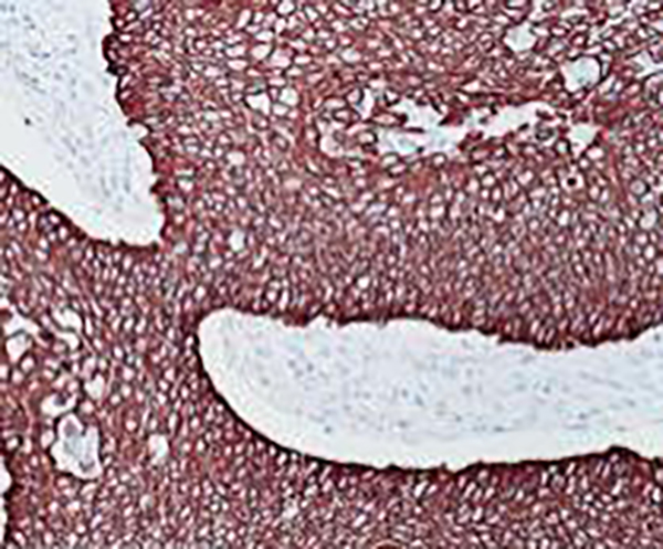 CD117 Recombinant Rabbit Monoclonal Antibody (clone BP6064)