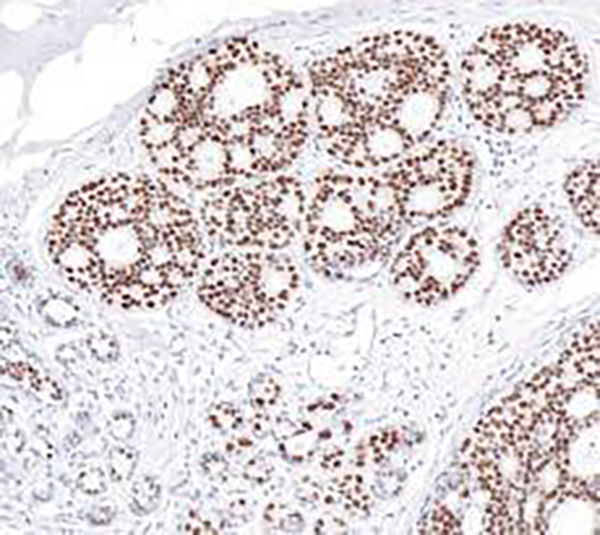 GATA-3 Recombinant Rabbit Monoclonal Antibody (clone BP6229)