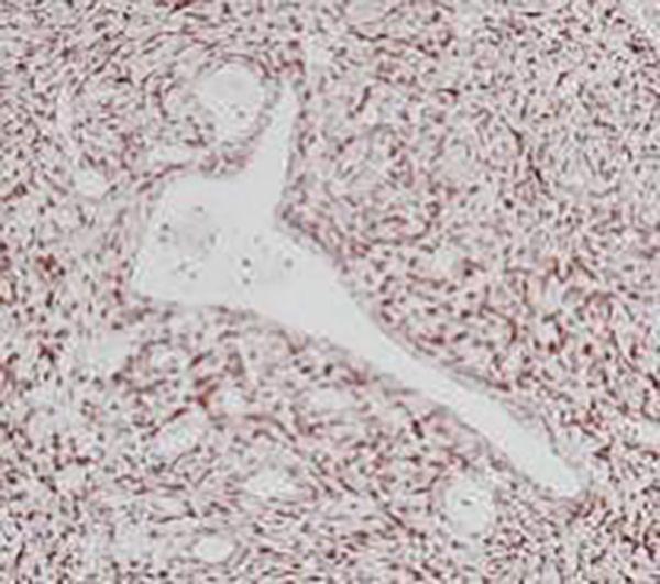 STAT6 Recombinant Rabbit Monoclonal Antibody (clone BP6193)