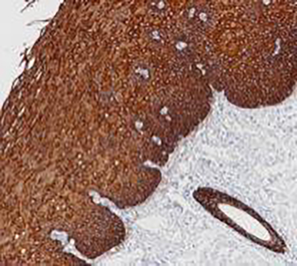 Cytokeratin Pan Recombinant Rabbit Monoclonal AntibodyCocktail (clone BP6051/BP6058)