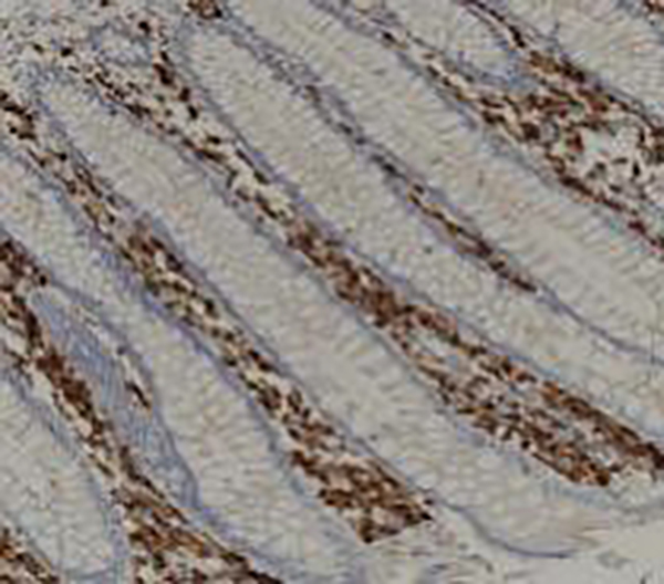 MUC4 Recombinant Rabbit Monoclonal Antibody (clone BP6121)