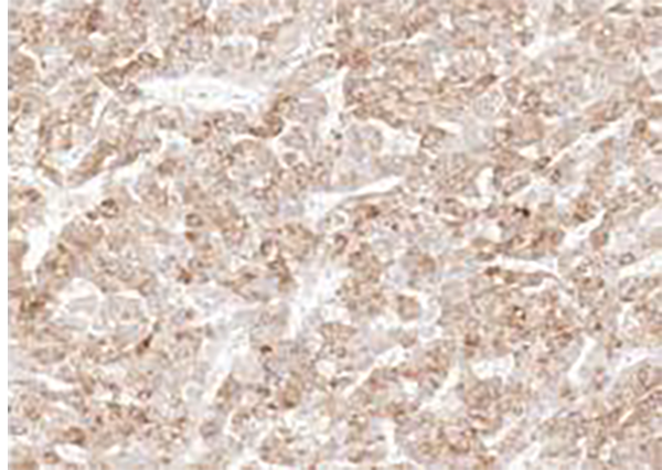 BAP-1 Recombinant Rabbit Monoclonal Antibody (clone BP6255)