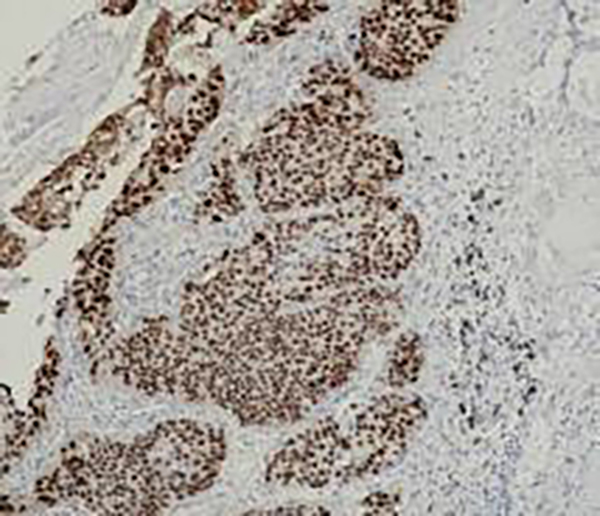 RRM1 Recombinant Rabbit Monoclonal Antibody (clone BP6122)