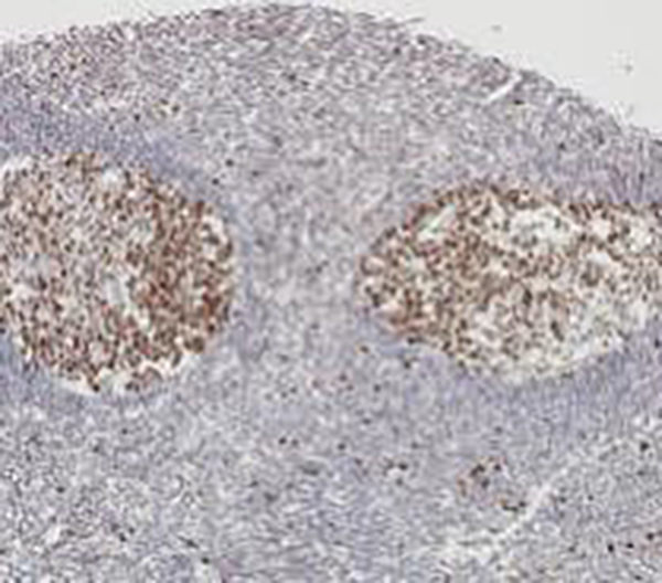 Ki-67 Recombinant Rabbit Monoclonal Antibody (clone BP6181)