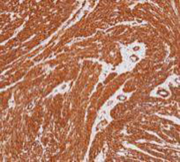 CD15 Recombinant Mouse Monoclonal Antibody (clone MMA)