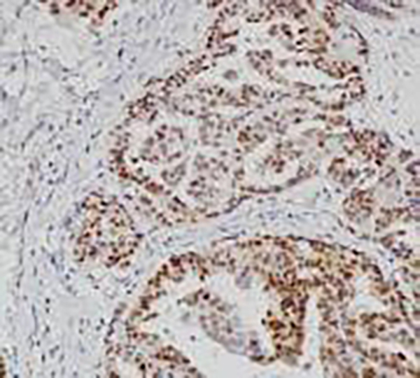 MGMT Recombinant Rabbit Monoclonal Antibody (clone BP6217)