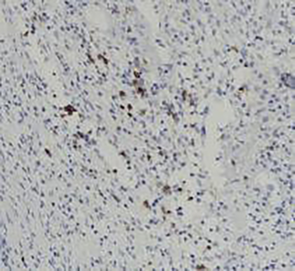 GCDFP-15 Recombinant Rabbit Monoclonal Antibody (clone BP6118)