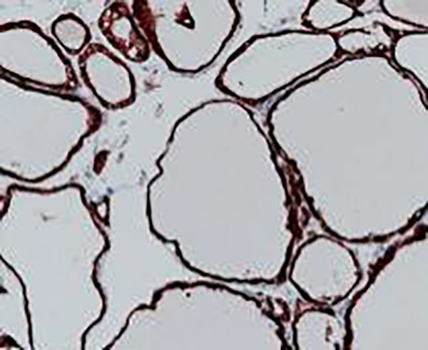 SOX11 Recombinant Rabbit Monoclonal Antibody (clone BP6070)