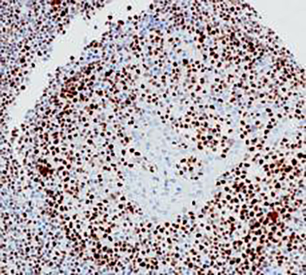 ROR gamma T Recombinant Rabbit Monoclonal Antibody (clone BP6233)
