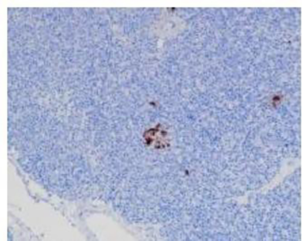 Uroplakin III Recombinant Rabbit Monoclonal Antibody (clone BP6199)