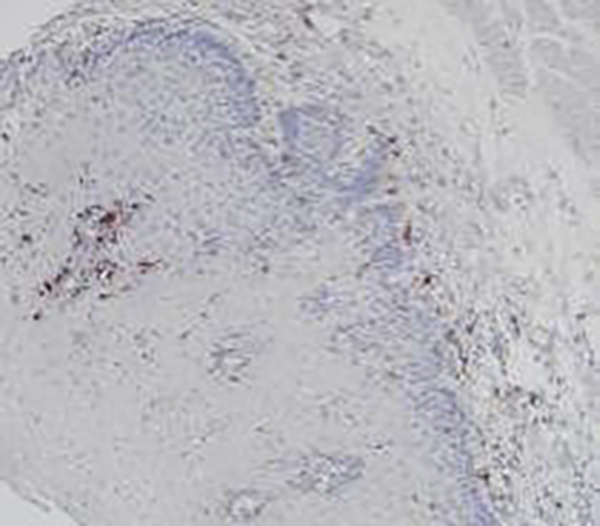 MHC II (DR &alpha; chain) Recombinant Rabbit Monoclonal Antibody (clone BP6170)