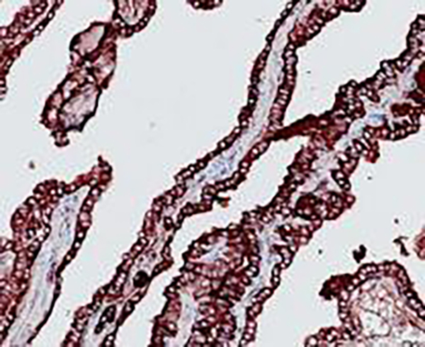 Villin Recombinant Rabbit Monoclonal Antibody (clone BP6066)