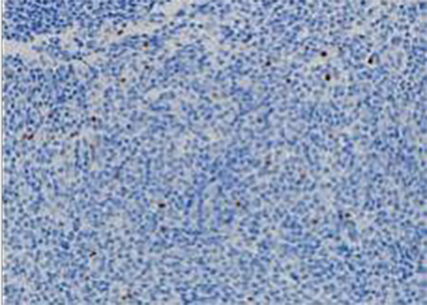 ALK Recombinant Rabbit Monoclonal Antibody (clone BP6165)