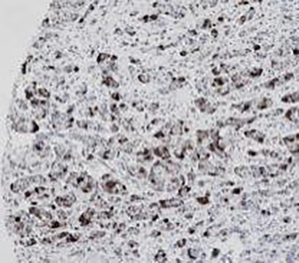 MyoD1 Recombinant Rabbit Monoclonal Antibody (clone BP6124)