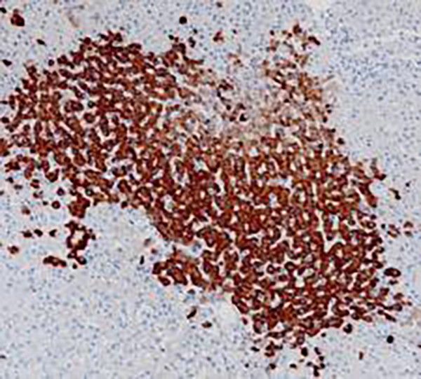 HBsAg Recombinant Rabbit Monoclonal Antibody (clone BP6224)