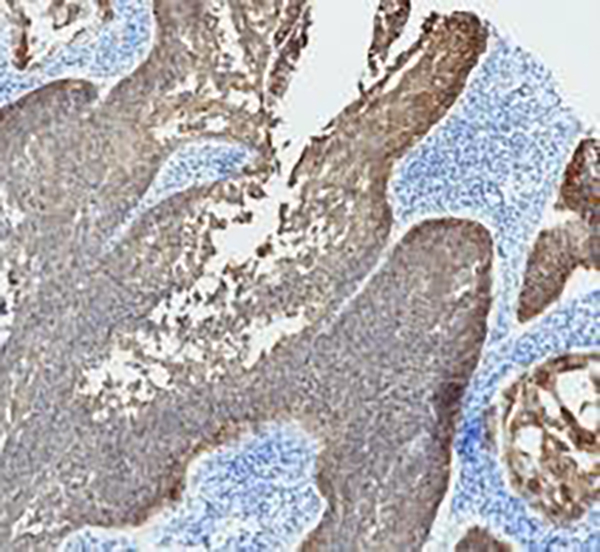 CD25 Recombinant Rabbit Monoclonal Antibody (clone BP6120)