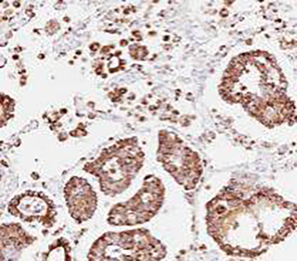 CD38 Recombinant Rabbit Monoclonal Antibody (clone BP6082)