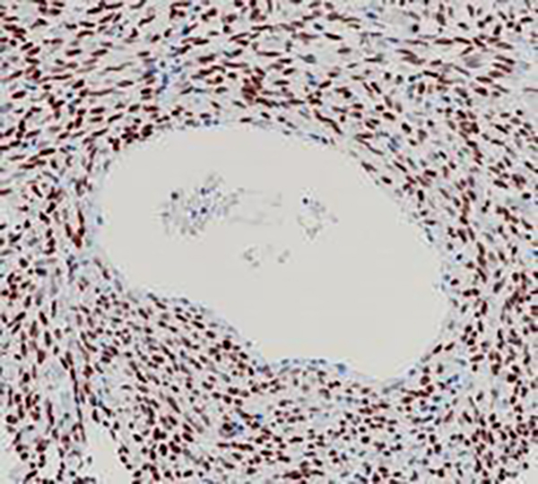 FOXL2 Recombinant Rabbit Monoclonal Antibody (clone BP6235)