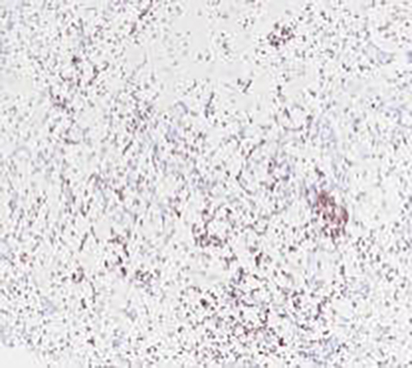 PHOX2B Recombinant Rabbit Monoclonal Antibody (clone BP6154)