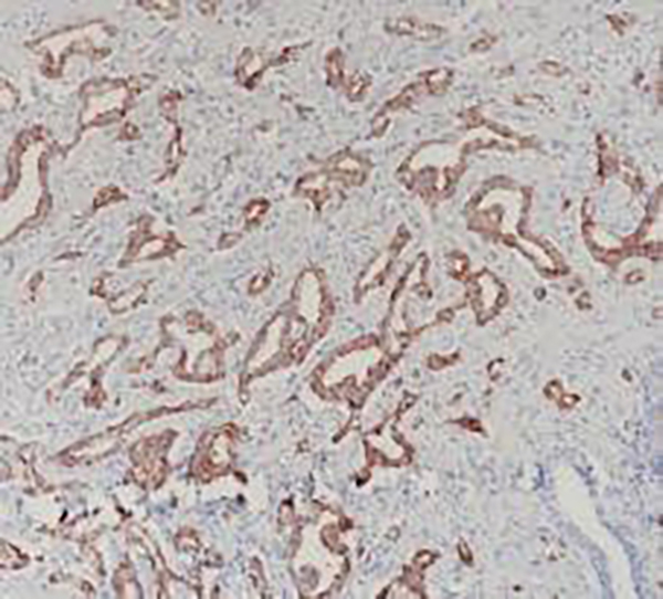 AMACR Recombinant Mouse Monoclonal Antibody (clone BPM6227)