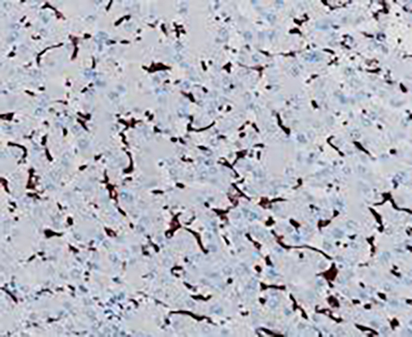WT1 Recombinant Rabbit Monoclonal Antibody (clone BP6062)