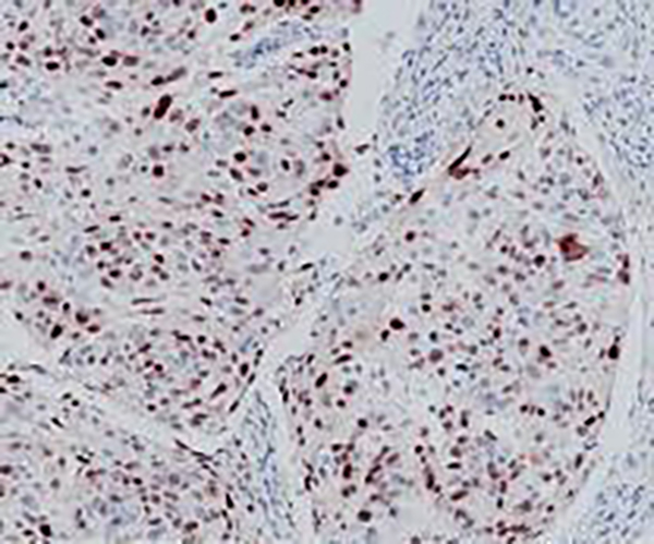 Thyroglobulin Recombinant Rabbit Monoclonal Antibody (clone BP6067)