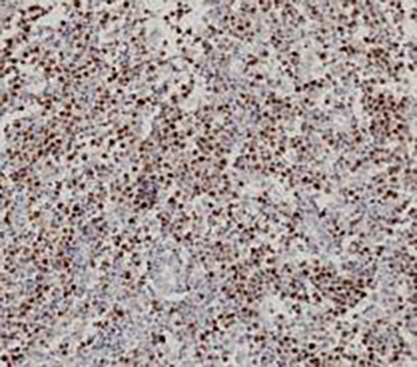 Podoplanin Recombinant Rabbit Monoclonal Antibody (clone BP6110)