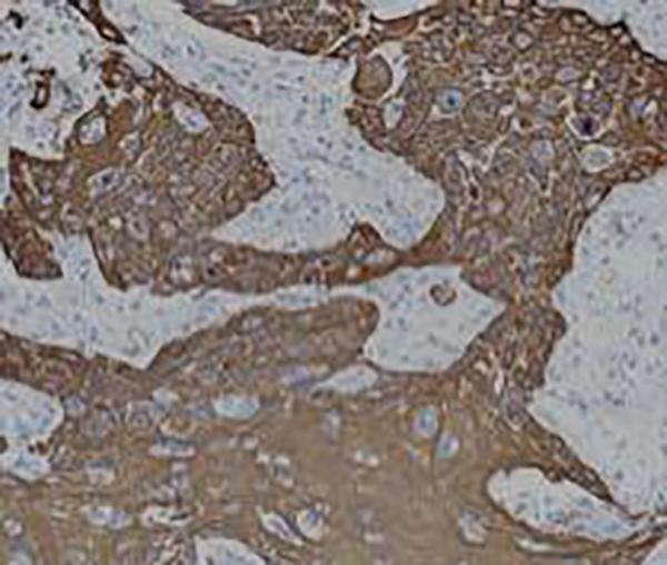 CD2 Recombinant Rabbit Monoclonal Antibody (clone BP6107)
