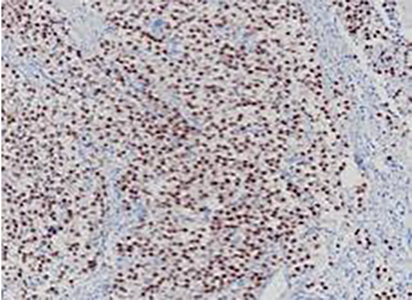NeuN Recombinant Rabbit Monoclonal Antibody (clone BP6163)