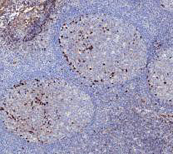 MHC II (DR &alpha; chain) Recombinant Rabbit Monoclonal Antibody (clone BP6171)