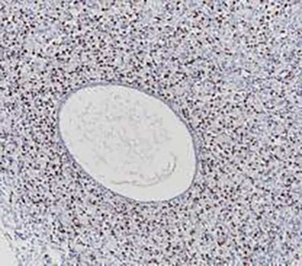 Progesterone Receptor Recombinant Rabbit Monoclonal Antibody (clone BP6136)