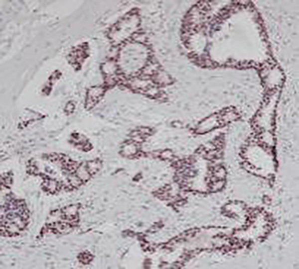 BRG1 Recombinant Rabbit Monoclonal Antibody (clone BP6201)